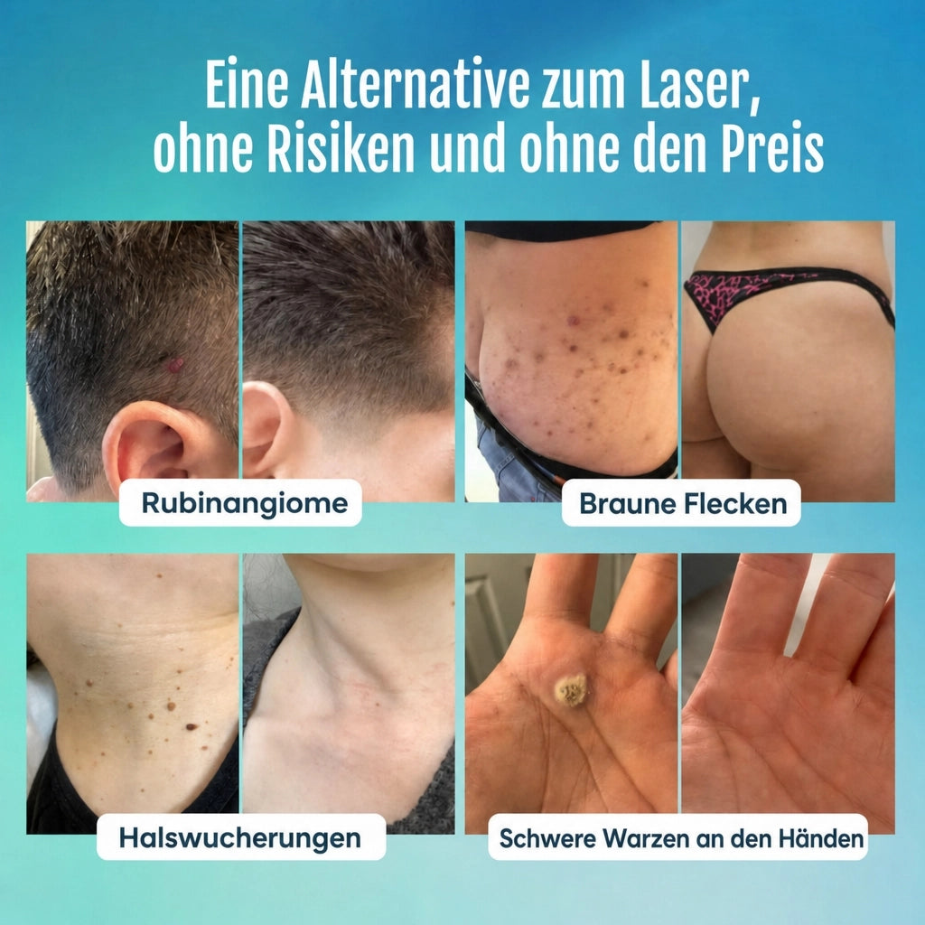 Fortschrittlicher Anti-Makel-Stift